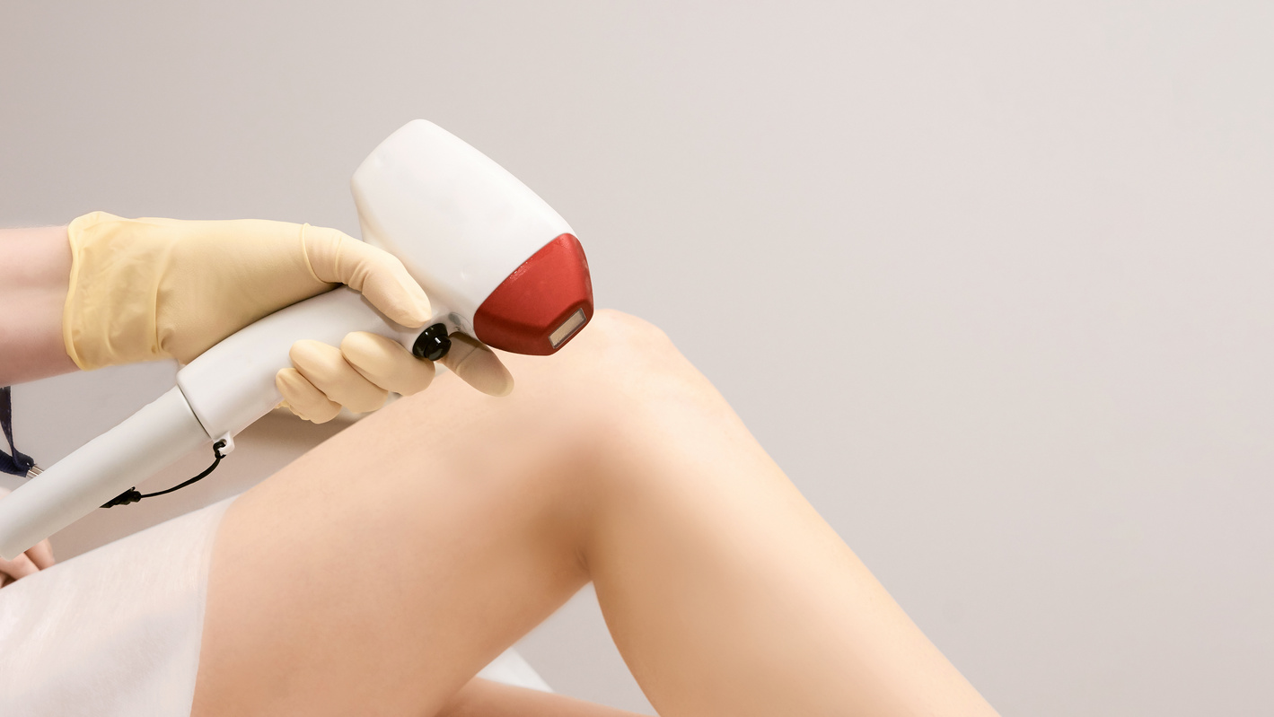 Laser Hair Removal  